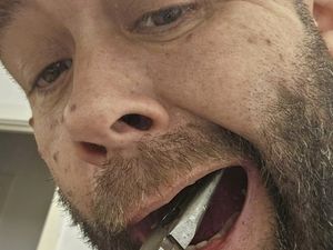 Supporting image for story: Dad who removed own tooth with pliers had 'no option' after failing to get dentist appointment