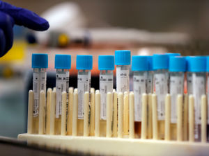 Supporting image for story: Probable Indian Covid variant case found in Sandwell