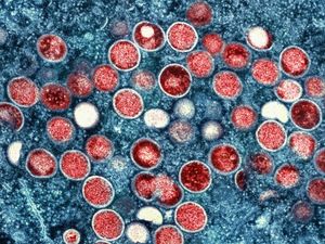 Supporting image for story: WHO considers public health emergency over mpox outbreak in Africa