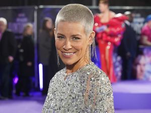 Supporting image for story: Marvel’s Evangeline Lilly says she had ‘hole punctured into face’ after fainting