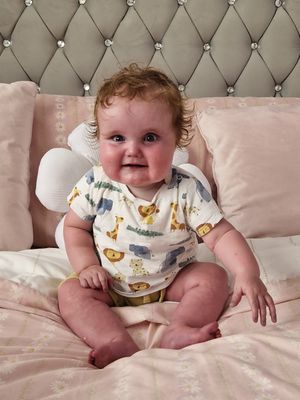 The surgery will cost 1.5 million pounds - but the family aren't giving up