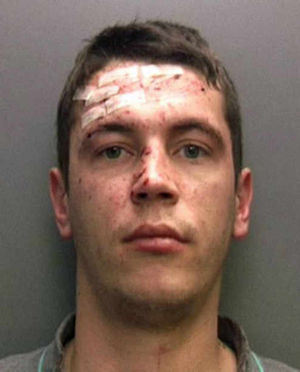 Scarred - Mantus Siskus