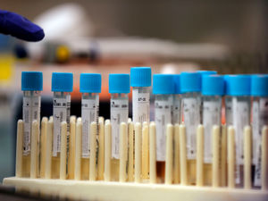 Supporting image for story: No further coronavirus deaths at Shropshire hospitals 