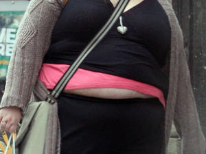 Supporting image for story: Poll: Should morbidly obese children be put into care?