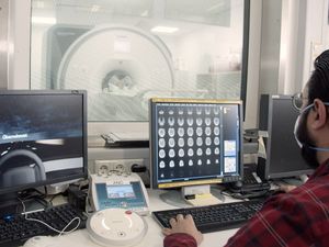 Supporting image for story: Ford’s brain research set to help identify drivers switching off at the wheel