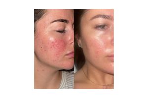 Jaime's results with 47 Skin