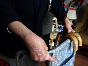 Supporting image for story: One in six Shropshire arthritis sufferers avoid painkillers for fear of side effects or addiction