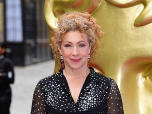 Supporting image for story: Alex Kingston: I was not reading the signs from my body before cancer diagnosis