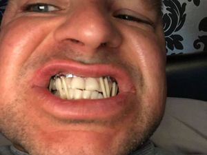 Supporting image for story: Man left with broken jaw after attack