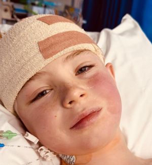 Max after his brain surgery