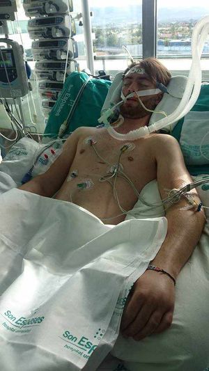 Jacob Nicol is being treated in PRH in Telford