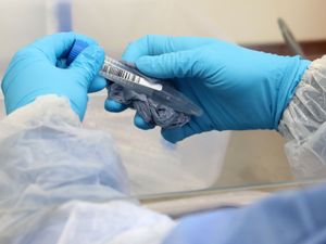Supporting image for story: Virus rates are on the way down for Shropshire and Mid Wales