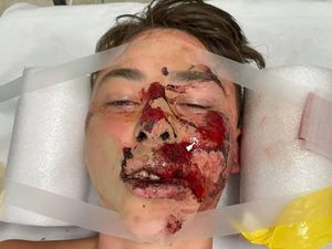 Supporting image for story: Cyclists urged to wear helmets after Shrewsbury teenager's multiple injuries
