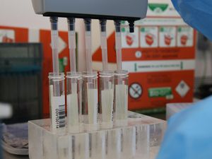 Supporting image for story: Highest daily increase in Covid-19 cases since outbreak began