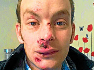 Supporting image for story: Man, 32, attacked in Wem street robbery