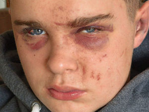 Supporting image for story: Cash pledge for CCTV after Newtown assaults 