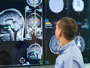 Supporting image for story: Experts analyse brain scans in bid to develop tool to predict dementia risk