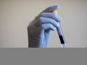 a paramedic holding a test tube containing a blood sample.