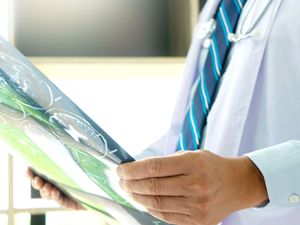 Supporting image for story: Mobile stroke units ‘could cut emergency admissions in Scotland by 86%’ – study