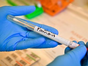 Supporting image for story: Faulty gene linked to dementia ‘doubles the risk of severe Covid-19’