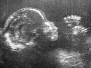 Supporting image for story: Letter: Alarmed by pair's view on abortion