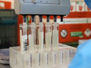 Supporting image for story: Another 19 Covid deaths confirmed in Shropshire