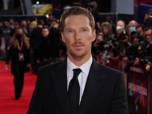 Supporting image for story: Benedict Cumberbatch stuns fans with unusual Vanity Fair photoshoot