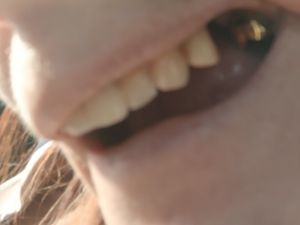 Supporting image for story: Wolverhampton woman awarded compensation after botched dental work