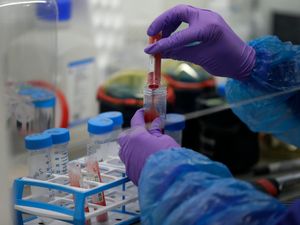 Supporting image for story: Computing issue responsible for sharp Covid-19 case rise, says Johnson