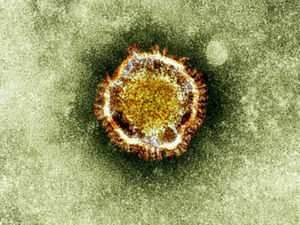Supporting image for story: Express & Star comment: Coronavirus not just taking lives