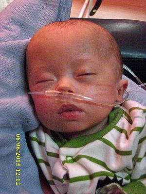 Baby Jude, who died in June 2015