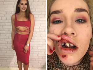 Supporting image for story: Wolverhampton student too scared to return to city after brutal attack