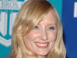 Supporting image for story: Anne Heche remains on life support to search for organ match – representative