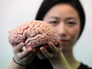 Supporting image for story: Fragmented sleep may be early sign of Alzheimer’s, study suggests