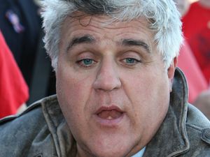 Supporting image for story: Jay Leno recovering after suffering ‘serious burns’ from gasoline fire