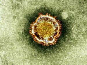 Supporting image for story: Express & Star comment: Fallout from new variant is profound