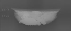 An X-Ray of the Gobowen Hoard. Pic: British Museum Trustees