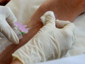 Supporting image for story: First-of-its-kind tool to check potential inherited risk of pancreatic cancer