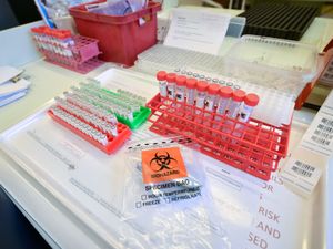 Supporting image for story: Covid-19 virus may not have emerged in China, WHO scientist claims