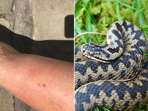 Supporting image for story: Walker bitten by adder in countryside near Ludlow 