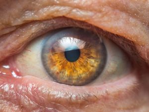 Supporting image for story: Double cataract surgery is better for patients, studies suggest