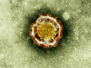 Supporting image for story: Peter Rhodes on crowded housing, wacky virus theories and reasons to be hopeful