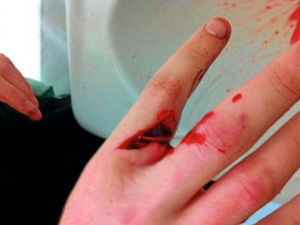 Supporting image for story: Shocking injuries of machete raid victims