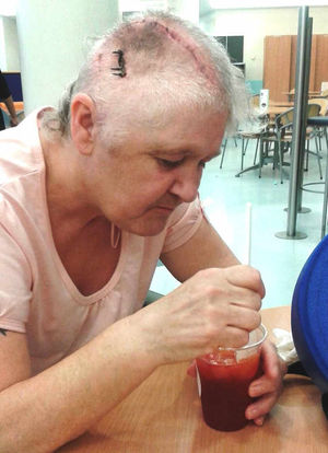 Deborah after having surgery