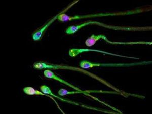 Supporting image for story: ‘Survivor’ sperm give rise to fitter longer-lived offspring, research shows