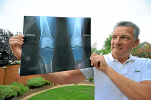 John Bennett holds up an x-ray of his legs after being injured in the infamous fiesta in Pamplona, Spain