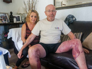 Supporting image for story: VIDEO: "There was a loud bang and I was enveloped in flames": Wife's quick thinking saves husband after fuel burner explosion