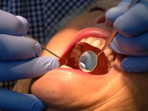 Supporting image for story: 2,000 dentists quit NHS last year leaving millions without care, reports say