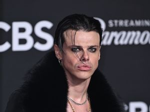 Supporting image for story: Yungblud to break from touring until the end of the year on advice of doctor