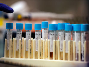 Supporting image for story: One new coronavirus death in Shropshire as England death toll rises by 866